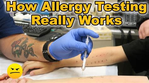 how to stop allergy testing